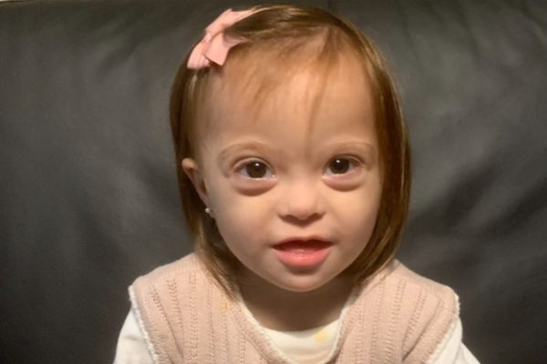 Bebê e Criança com Síndrome de Down: Um Universo de Amor e Aprendizado